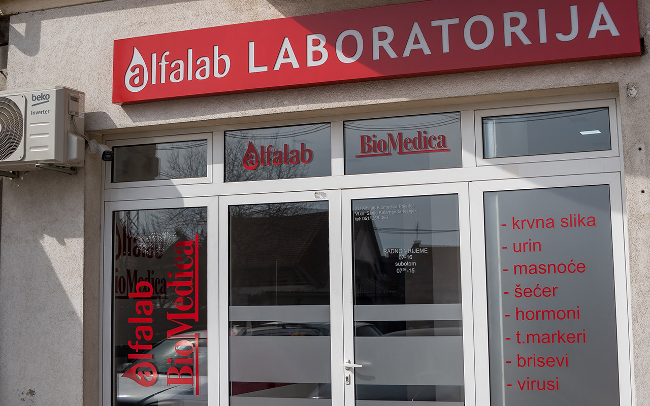 Obavijest – Alfalab laboratorija Prijedor